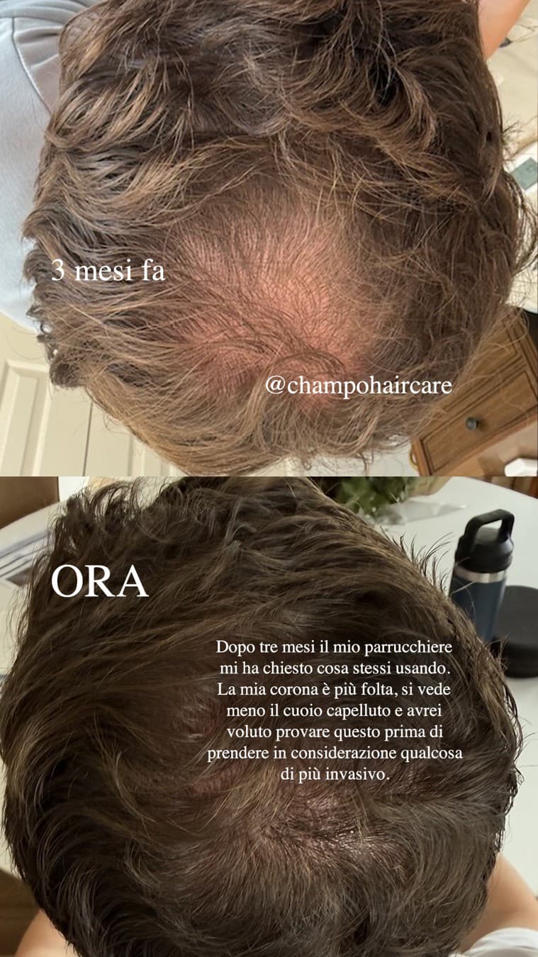 Chāmpo Haircare · Before and After ad