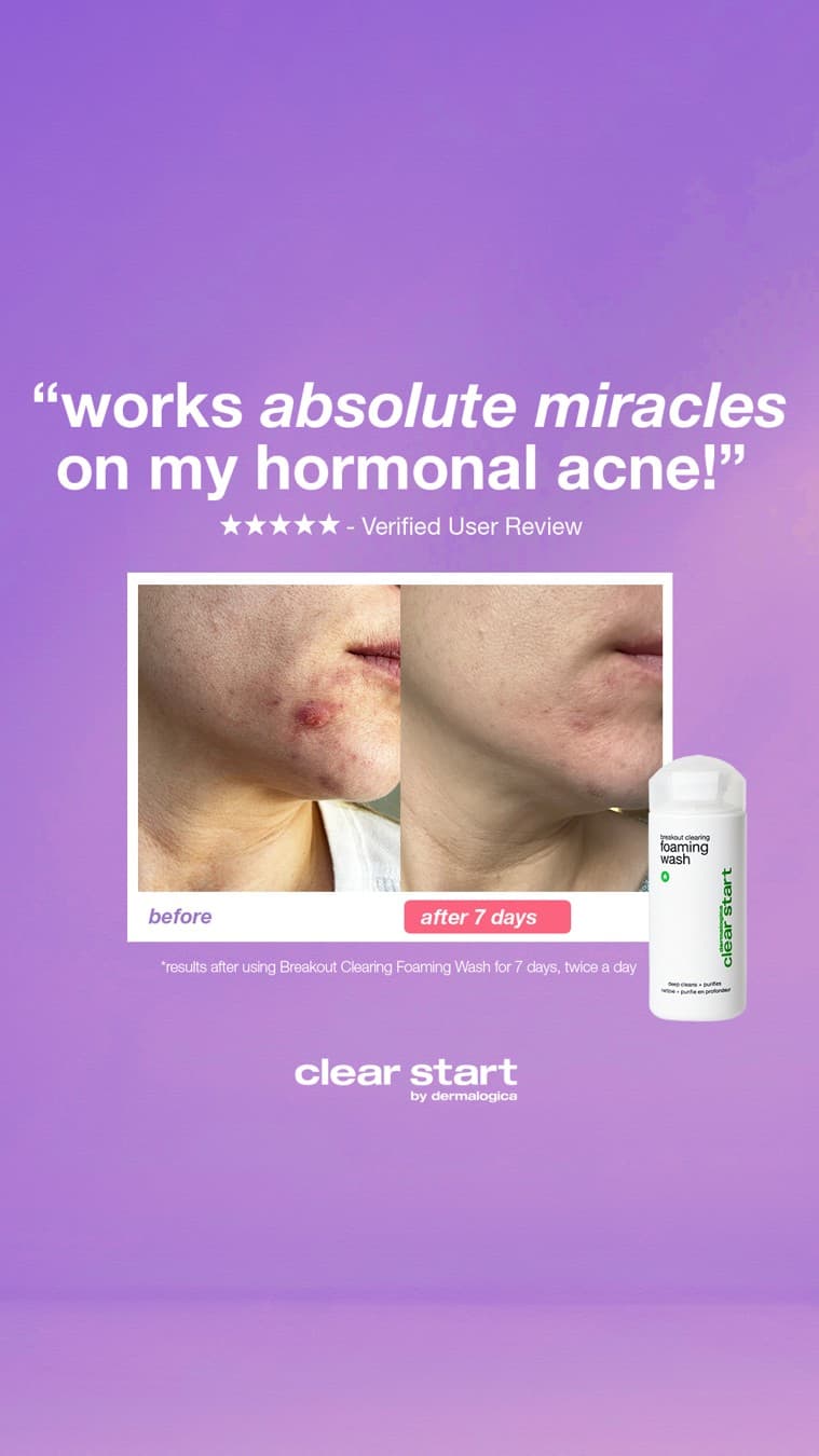 Dermalogica · Before and After ad