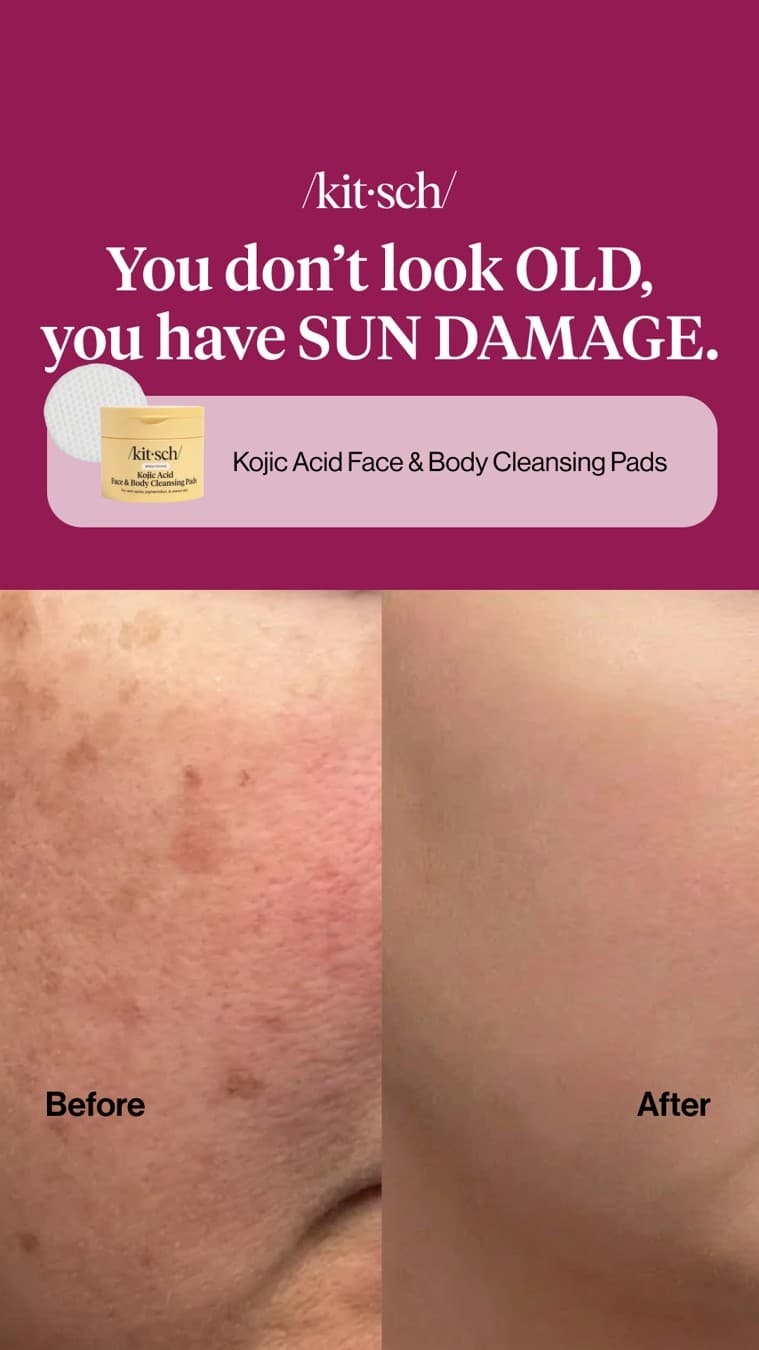 Kitsch · Before and After ad