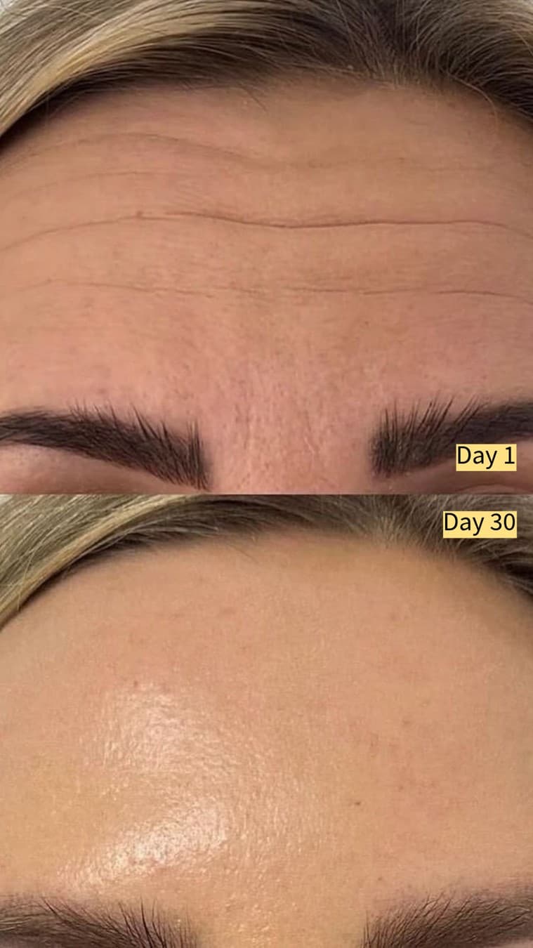 Frøya Organics · Before and After ad