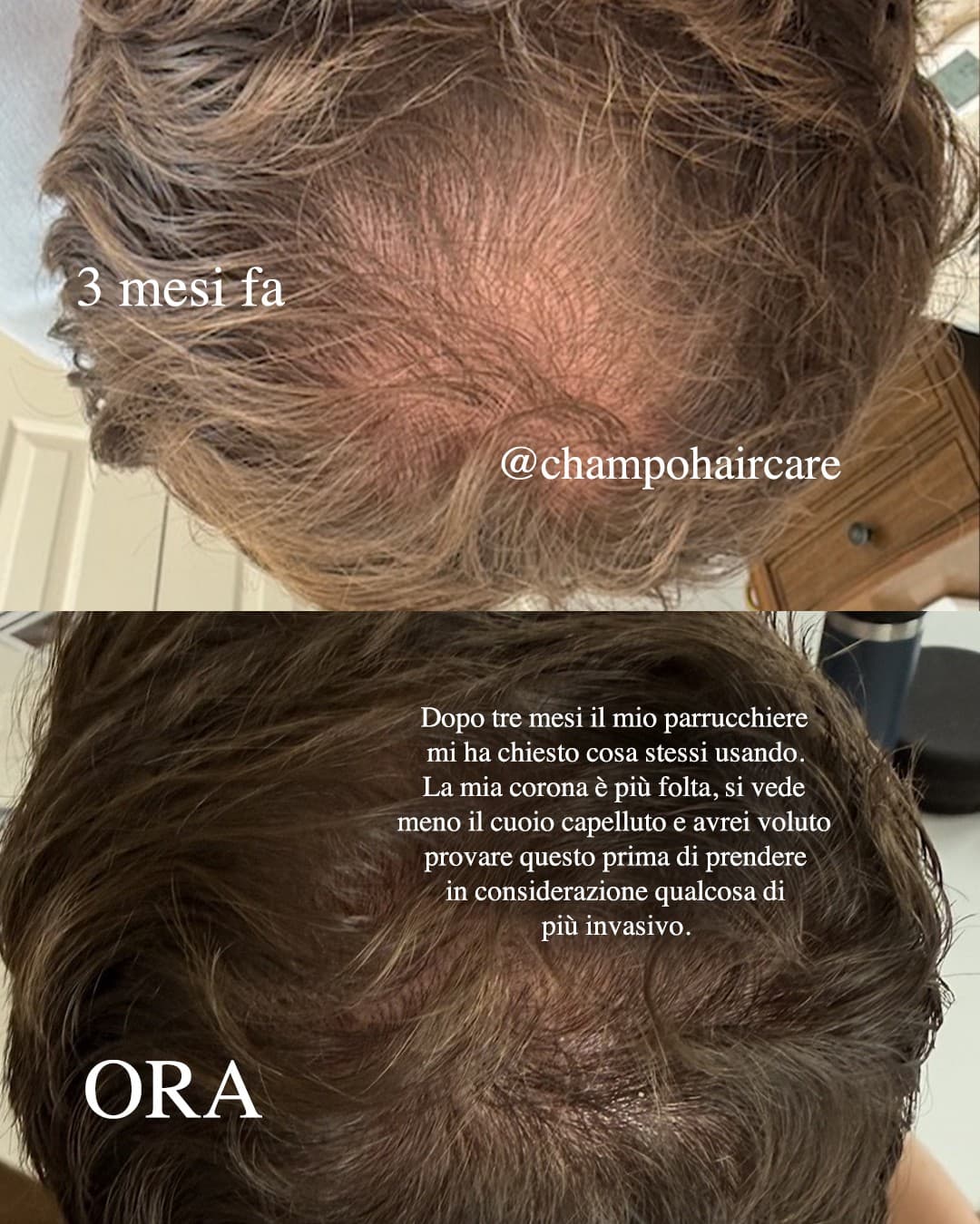 Chāmpo Haircare · Before and After ad