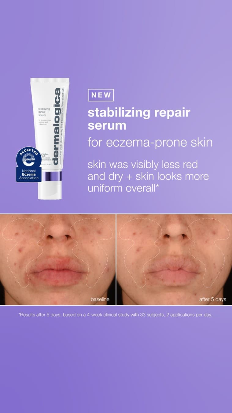 Dermalogica · Before and After ad