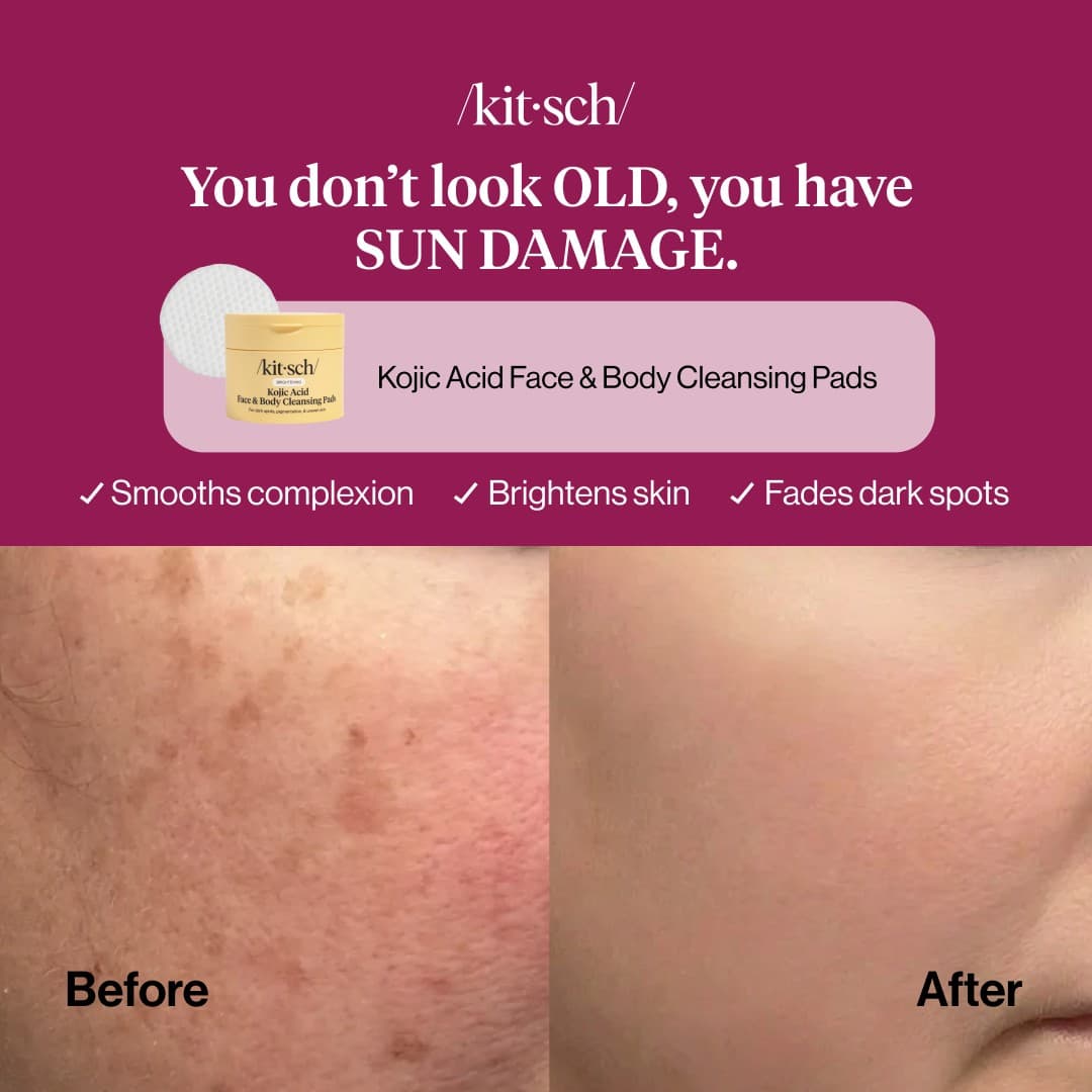 Kitsch · Before and After ad