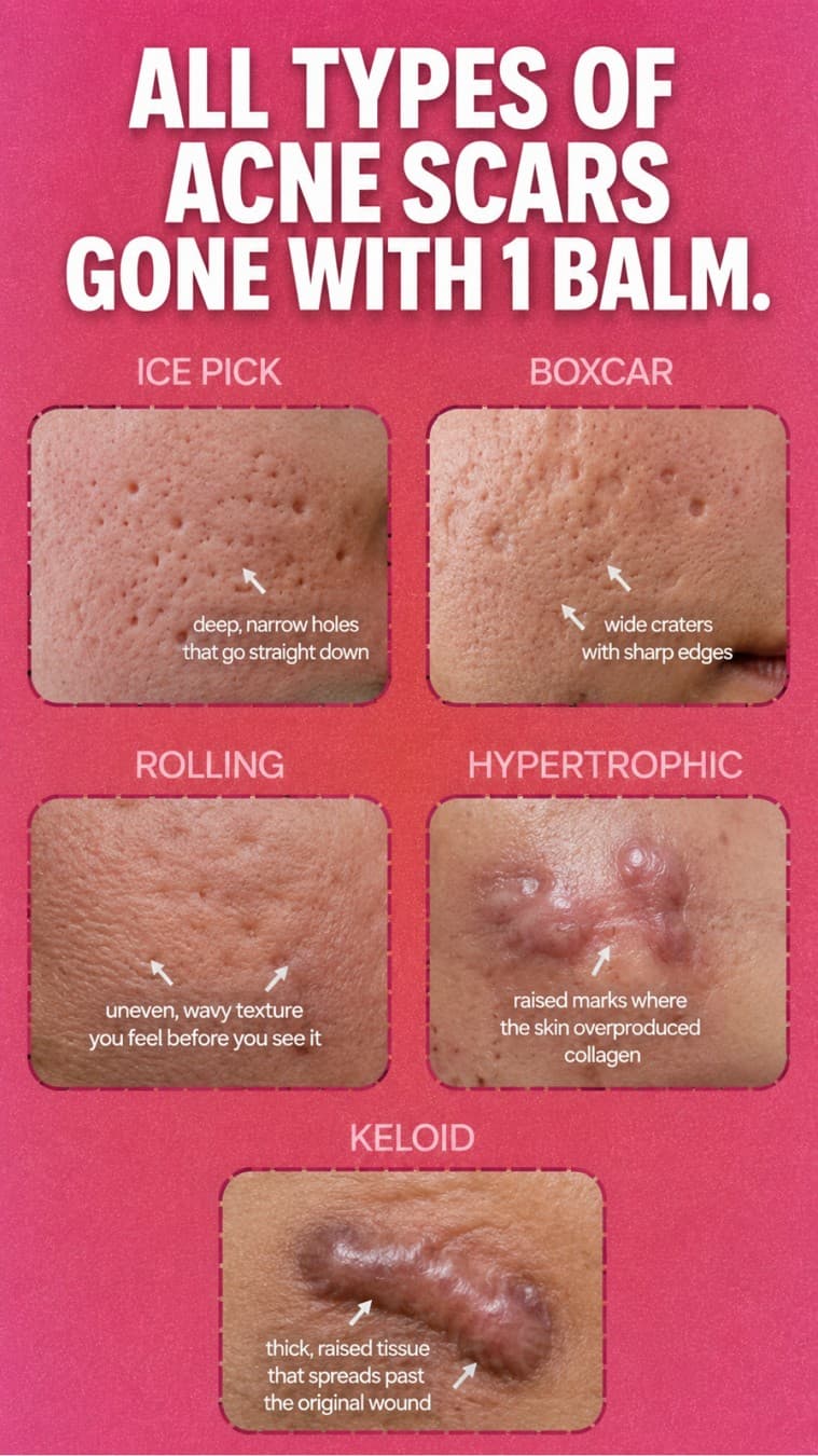 Norse Organics · Collage ad