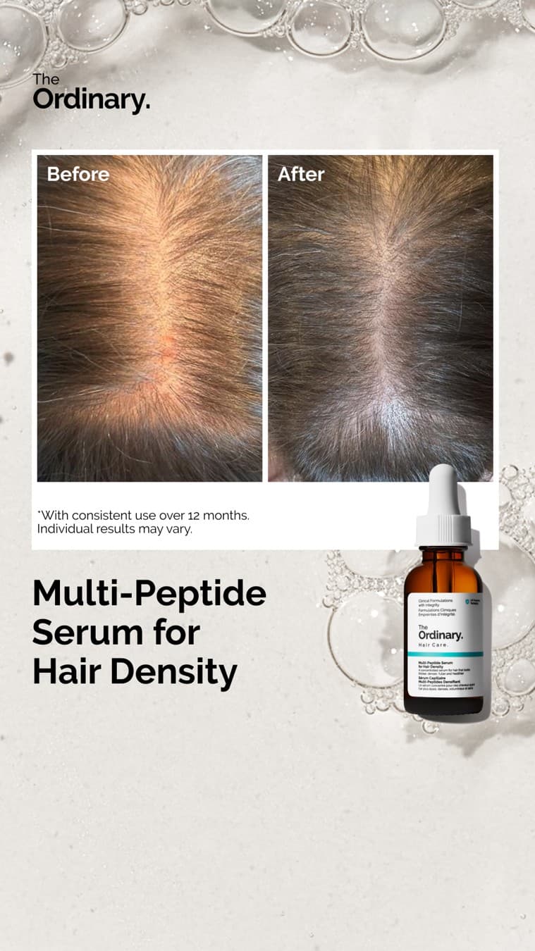 The Ordinary · Before and After ad