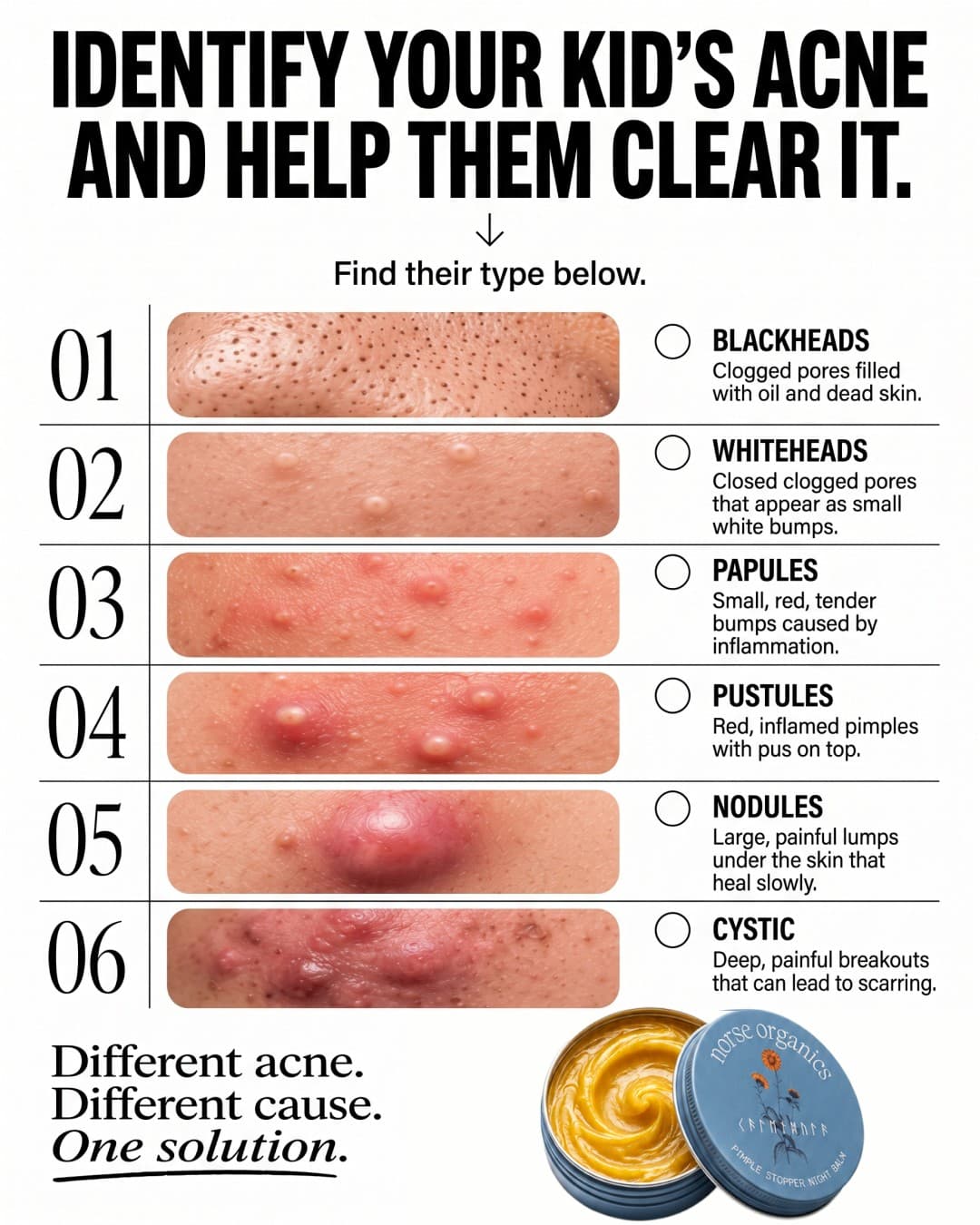 Norse Organics · Listicle ad