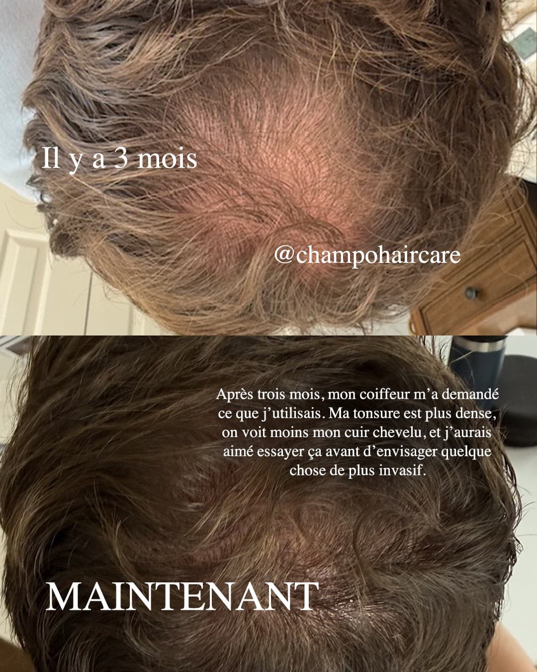 Chāmpo Haircare · Before and After ad