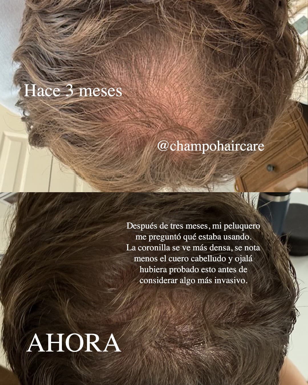 Chāmpo Haircare · Before and After ad