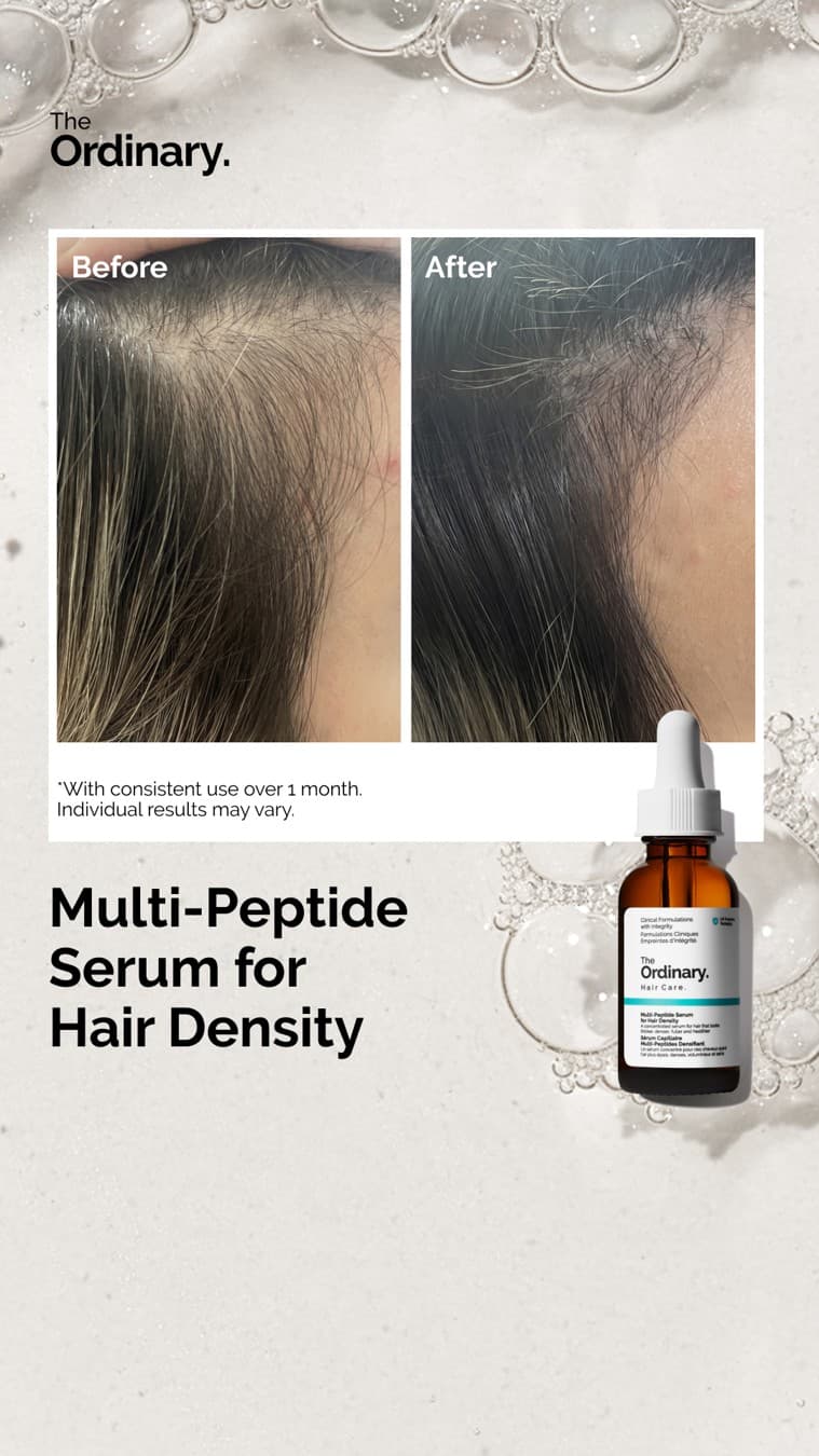 The Ordinary · Before and After ad
