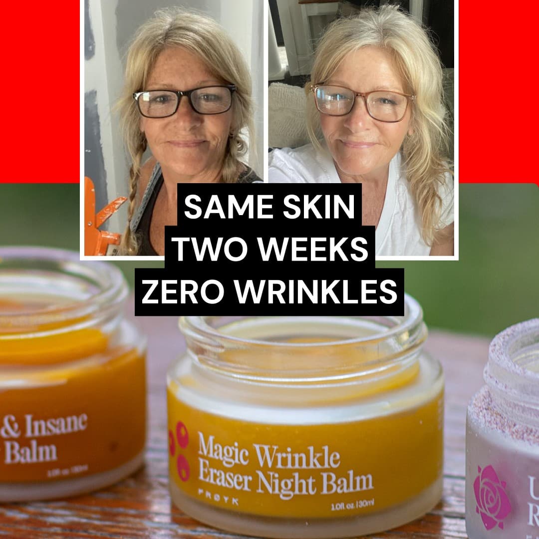 Frøya Organics · Before and After ad