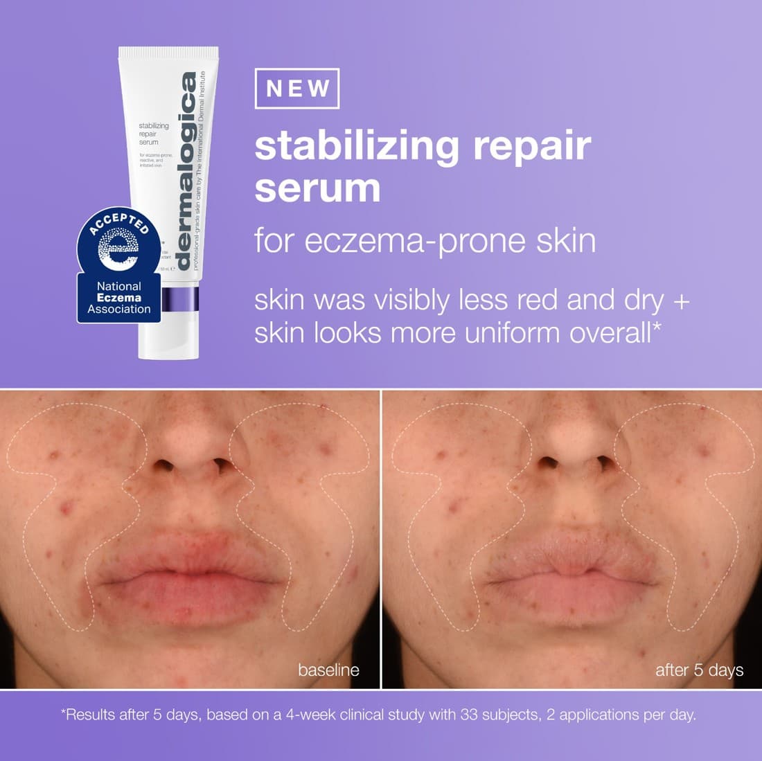 Dermalogica · Before and After ad