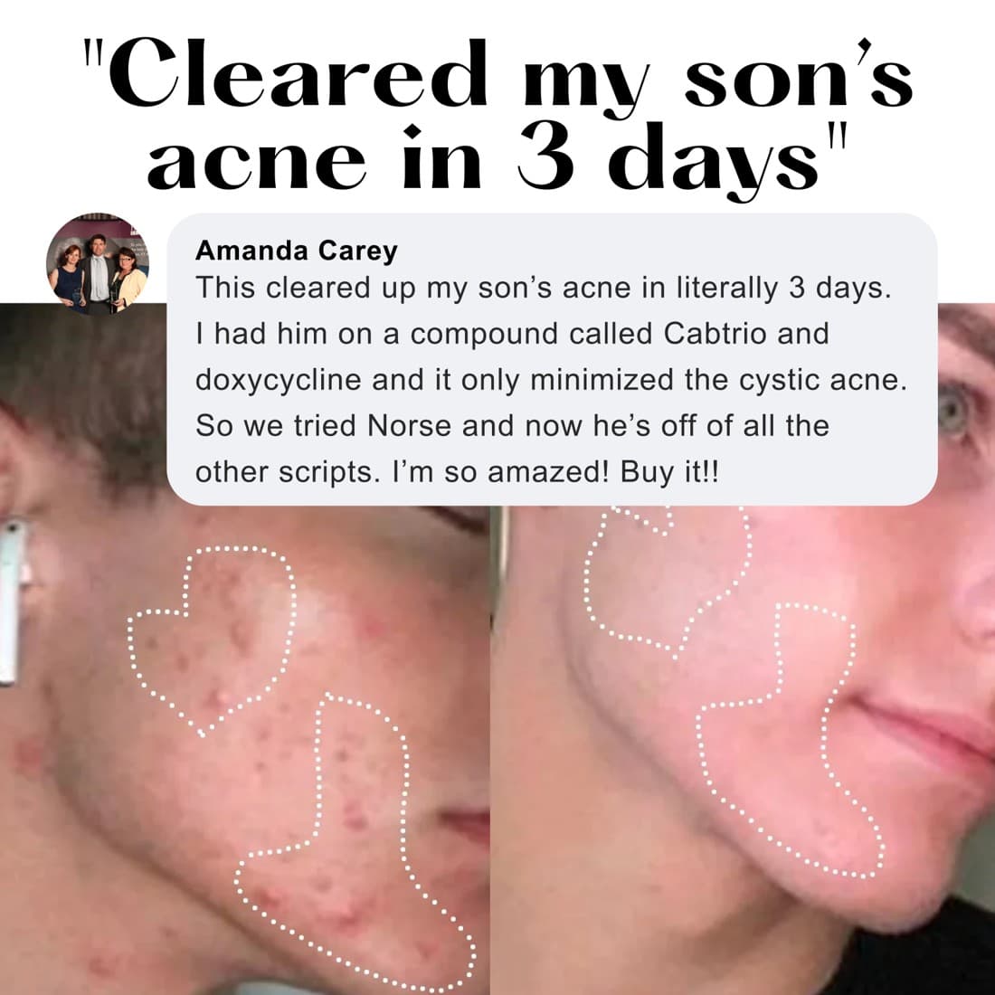 Norse Organics · Before and After ad