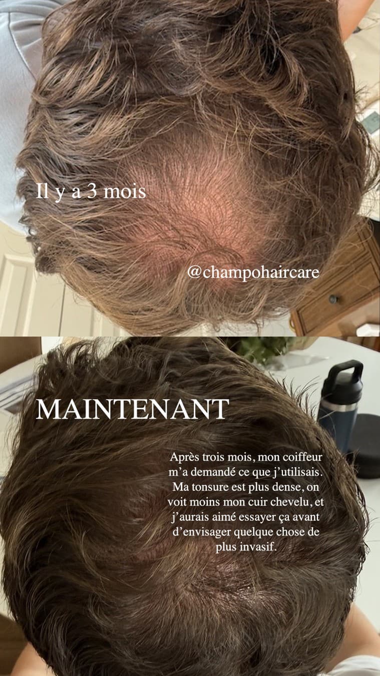 Chāmpo Haircare · Before and After ad