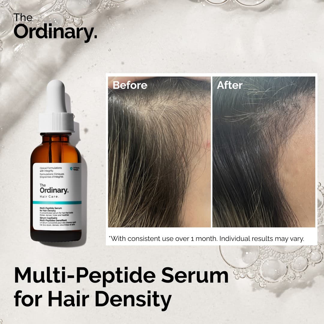 The Ordinary · Before and After ad