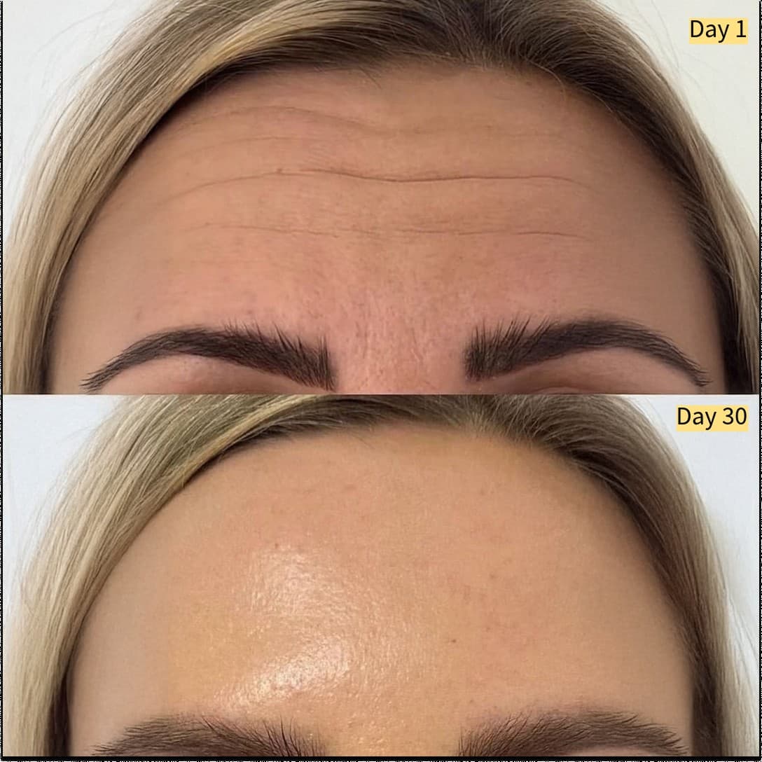 Frøya Organics · Before and After ad