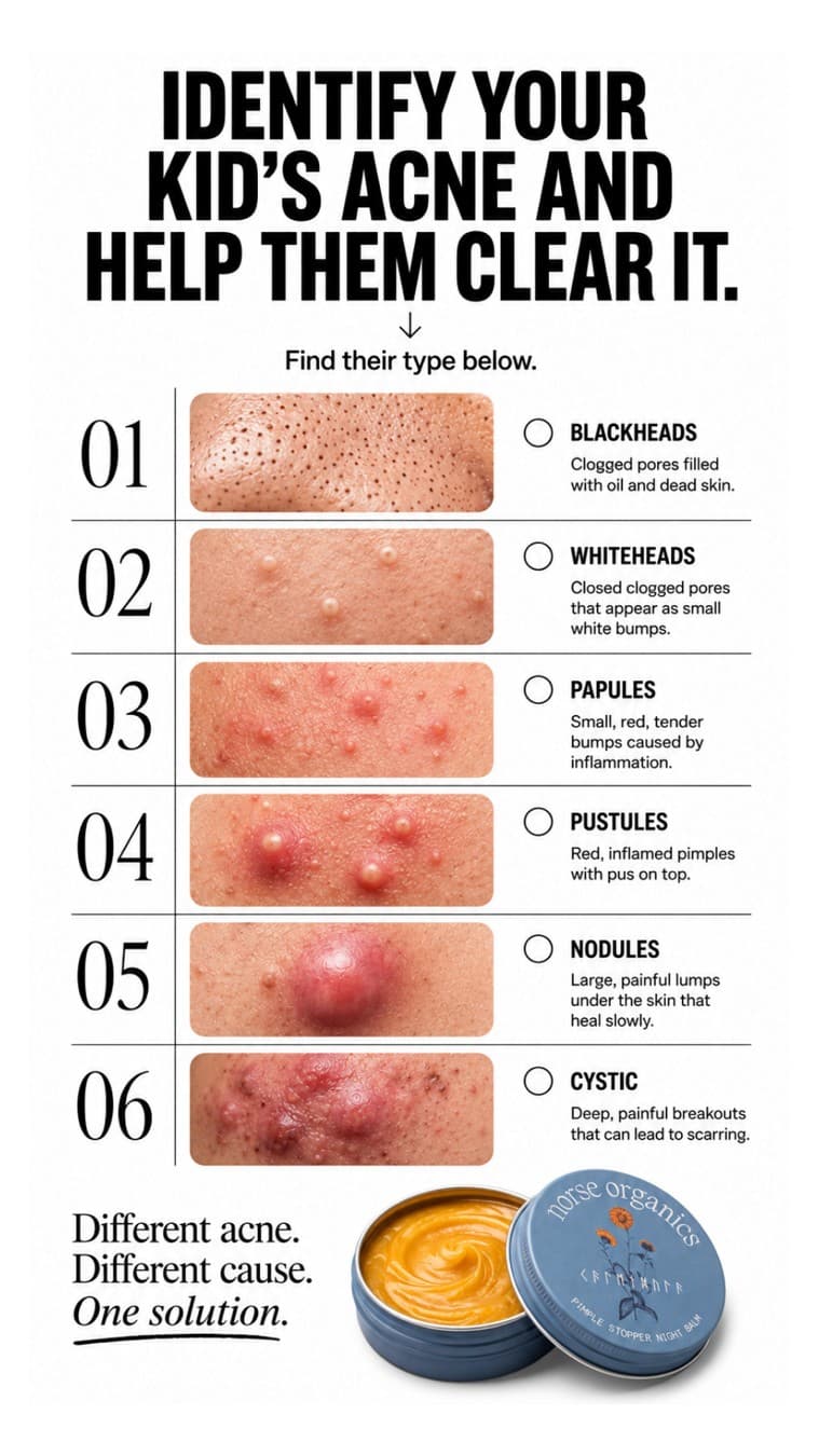 Norse Organics · Listicle ad