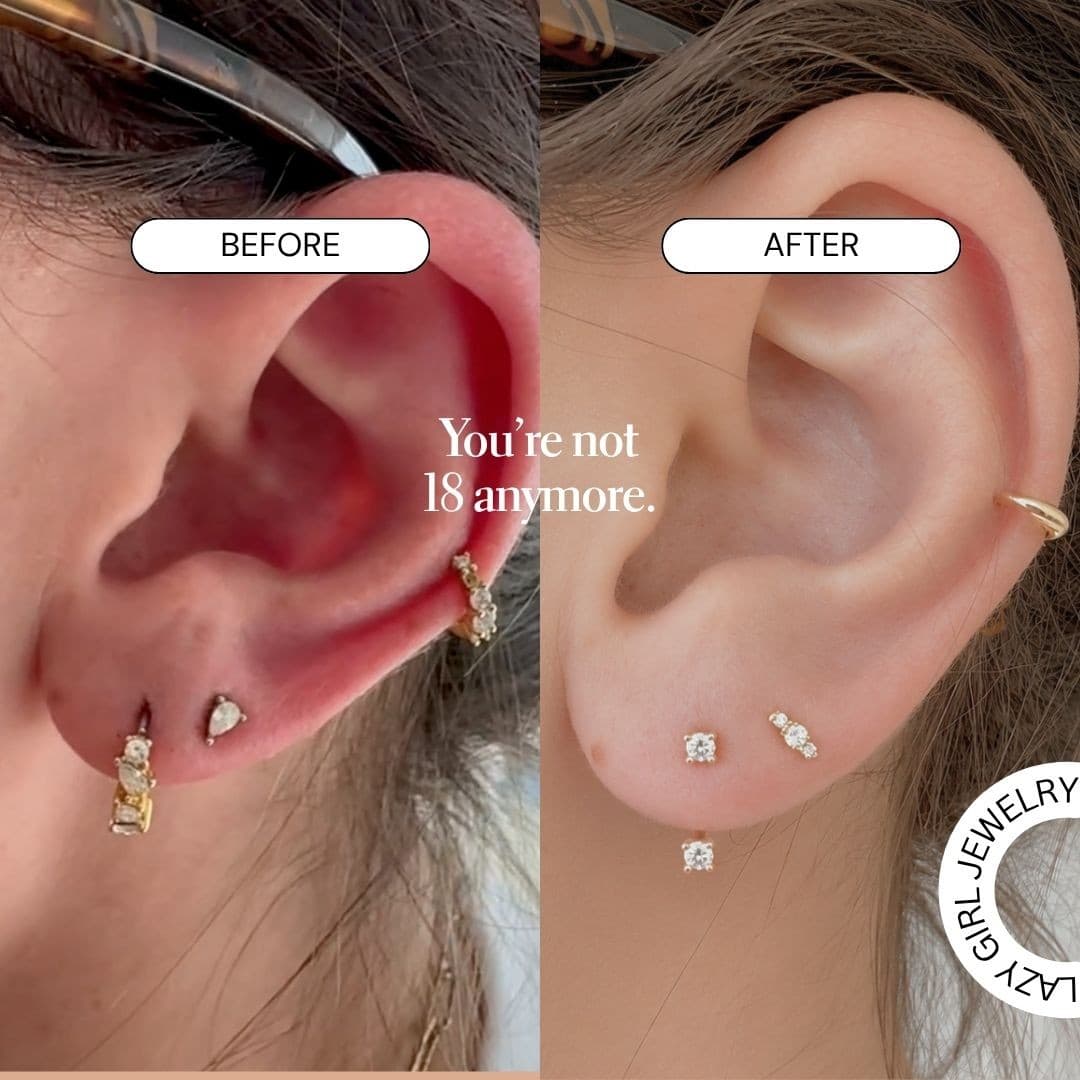 Adornmonde · Before and After ad