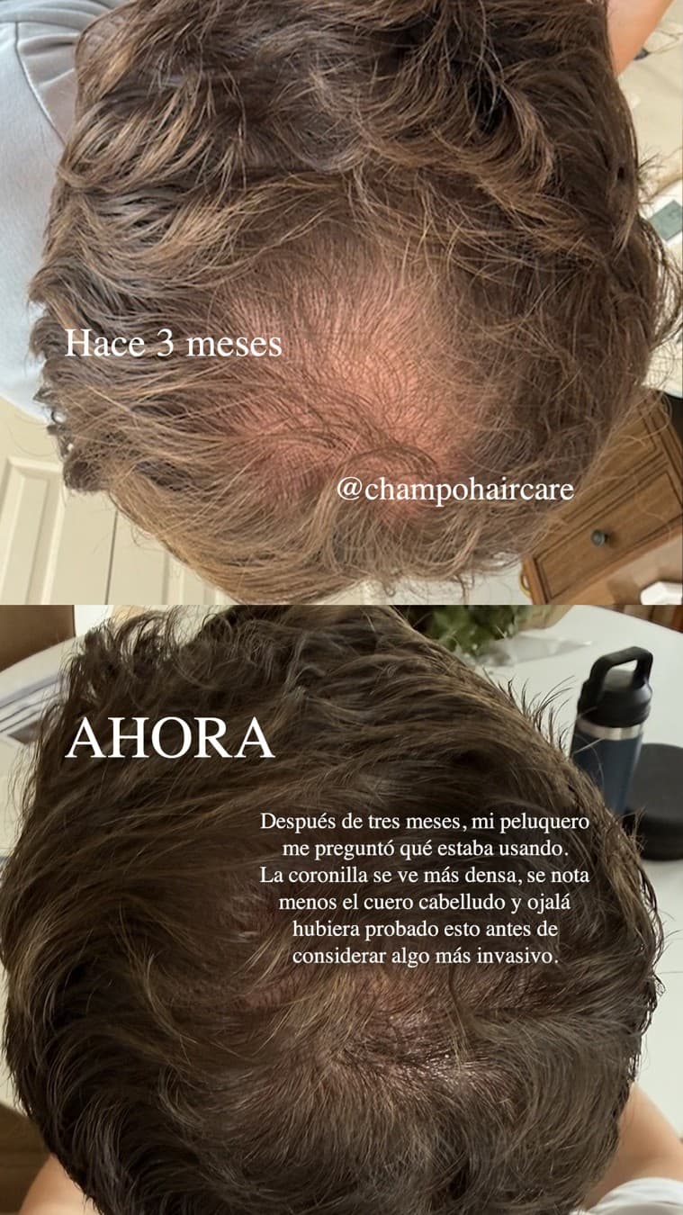 Chāmpo Haircare · Before and After ad