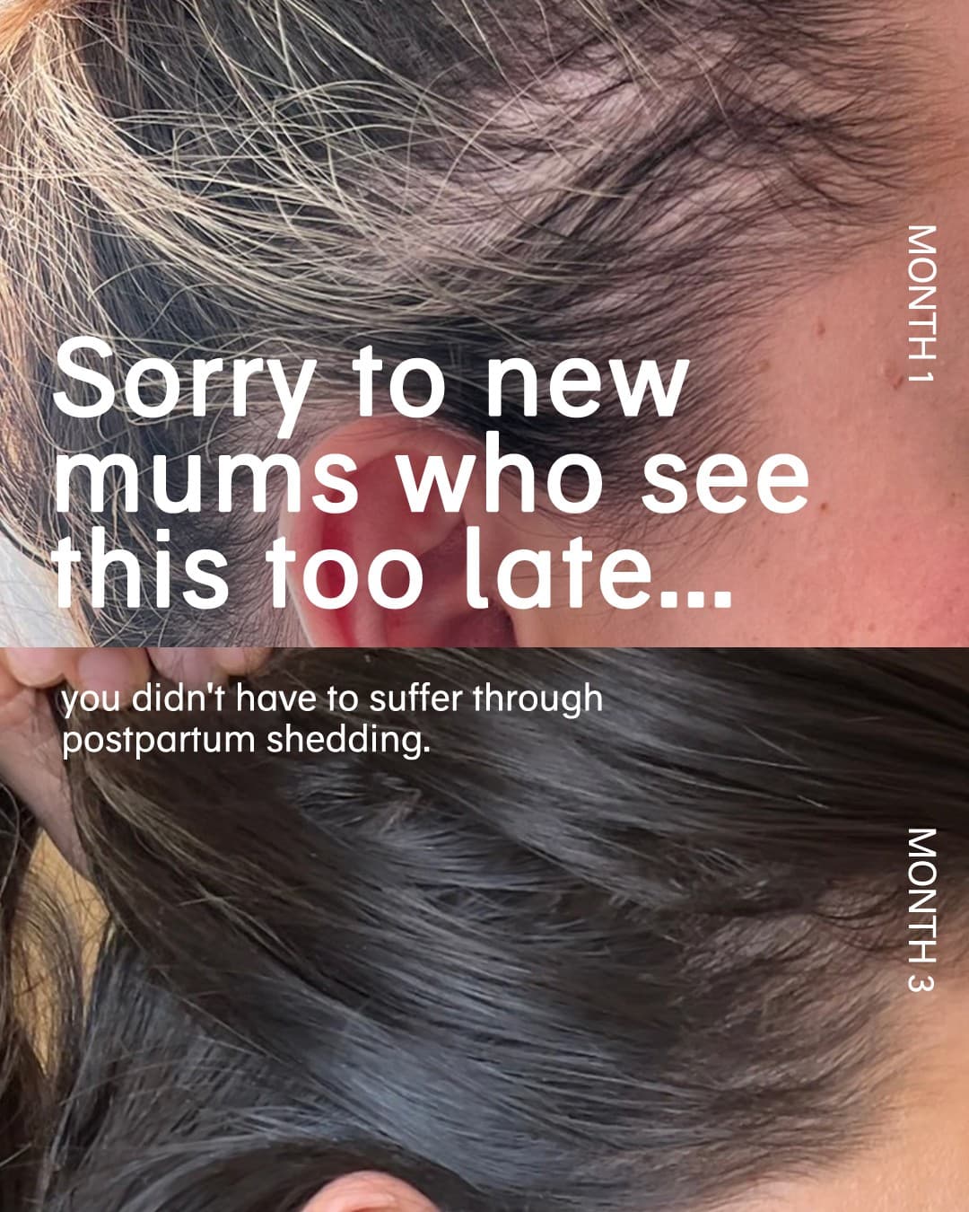 Chāmpo Haircare · Before and After ad