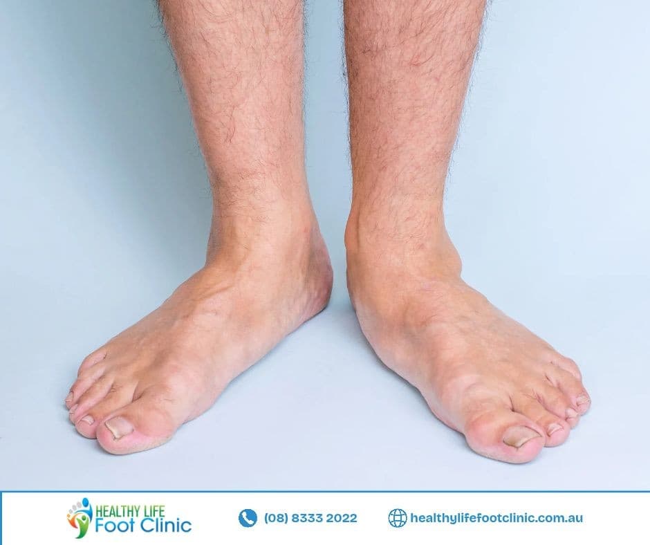 Healthy Life Foot Clinic · Other ad