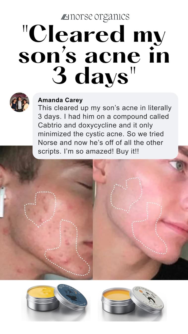 Norse Organics · Before and After ad