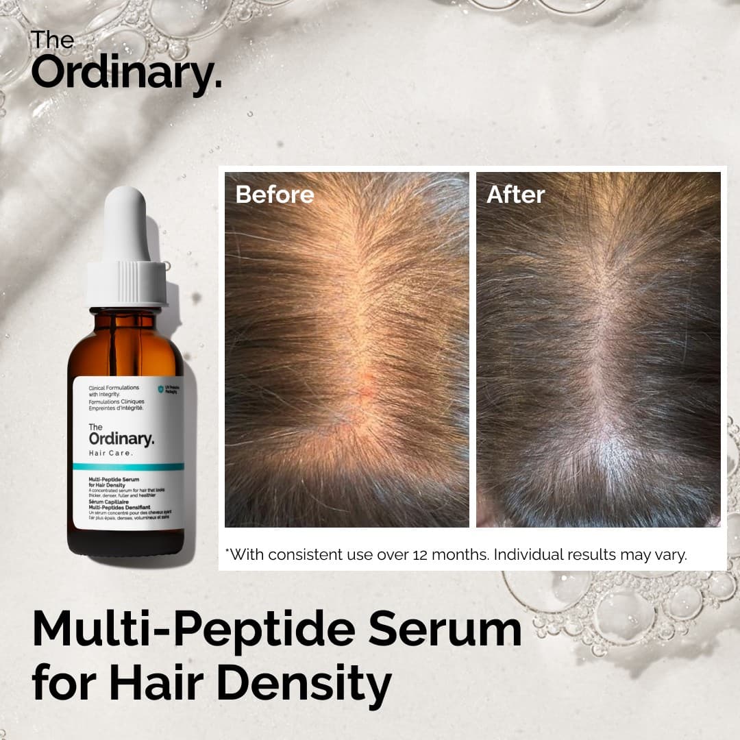 The Ordinary · Before and After ad