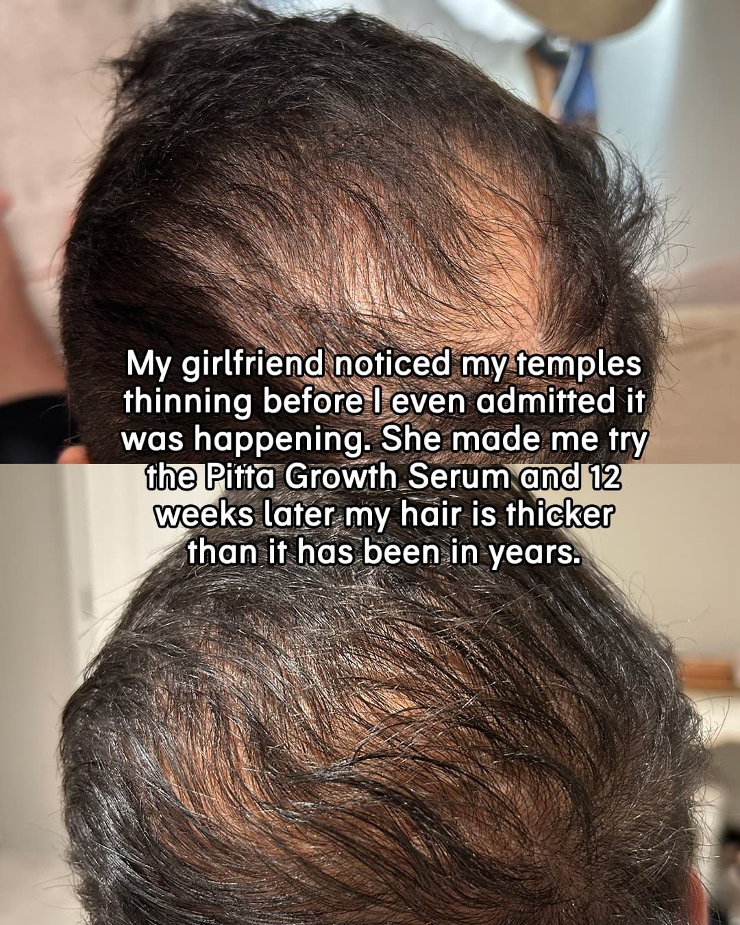 Chāmpo Haircare · Before and After ad